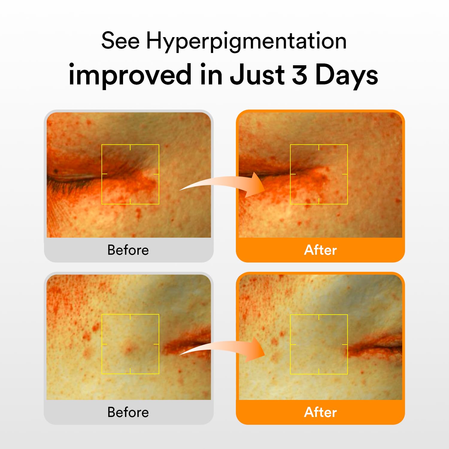 Abib Glutathiosome dark spot serum Vita drop 1.69 fl.oz