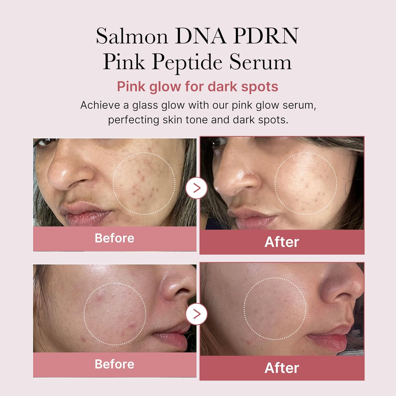 medicube Salmon DNA PDRN Pink Peptide Serum