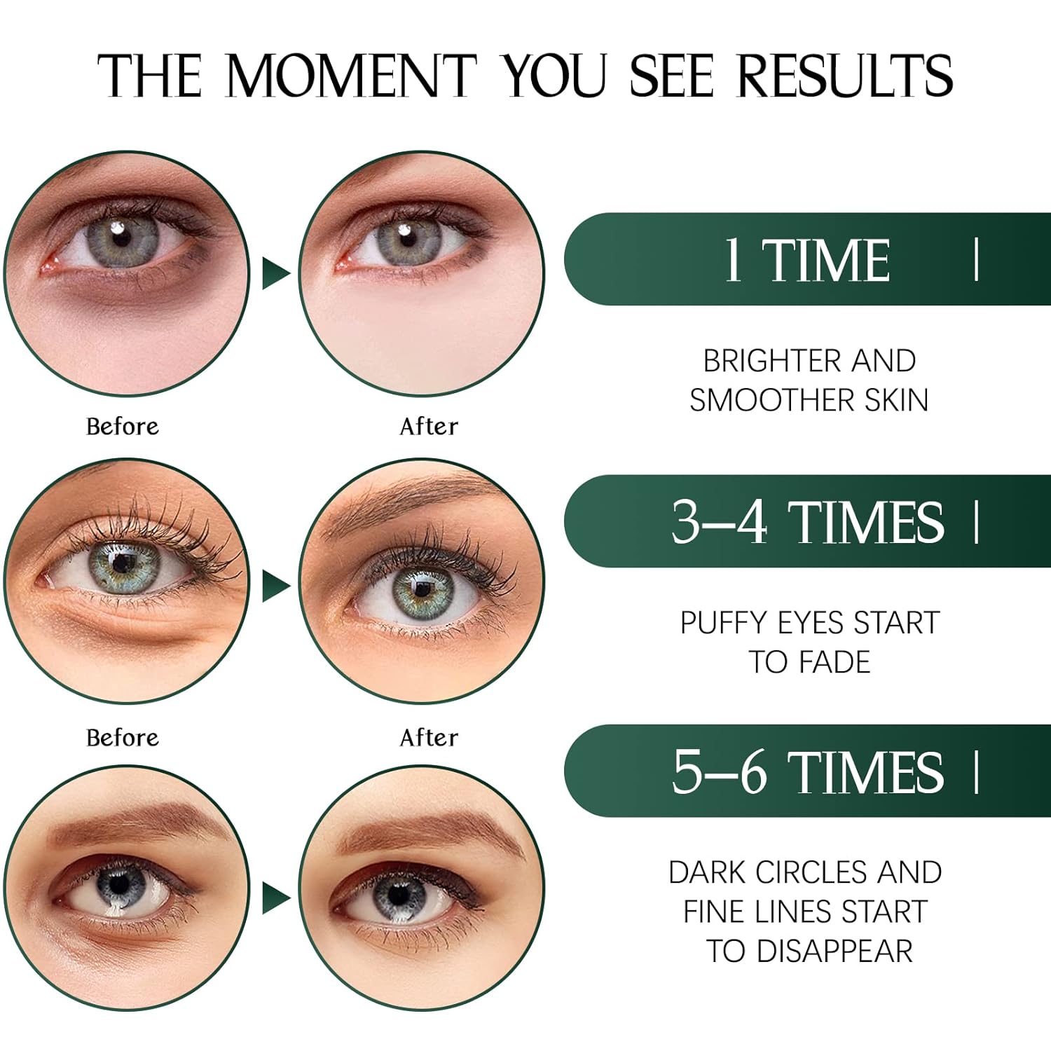 Tiepetly Under Eye Masks with Collagen